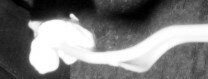 Is this Ectoplasm?