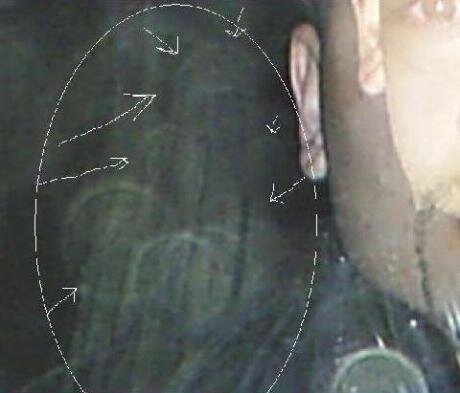 post mortem photos