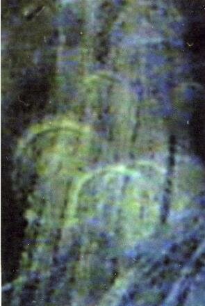 post mortem photos