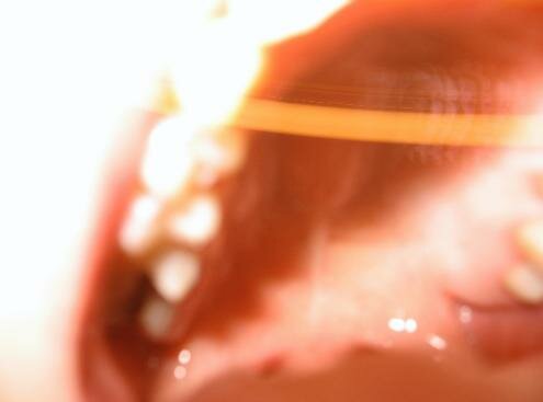 woman in the mouth ghost picture