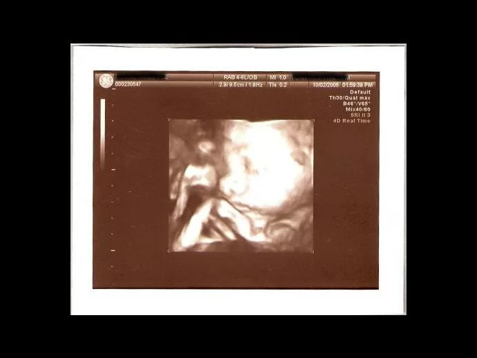 ultrasound angel photo